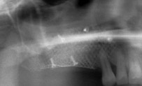 tac-prechirurgica-avellino-studio-dentistico-dargenio