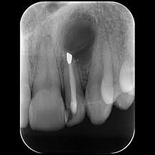 tac-prechirurgica-avellino-studio-dentistico-dargenio