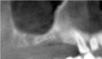 tac-prechirurgica-avellino-studio-dentistico-dargenio