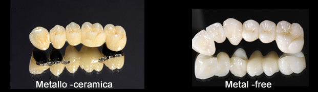 all on six - avellino studio dentistico dargenio