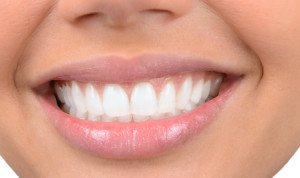 Dal bianco splendente alle faccette, il sorriso perfetto si crea al computer