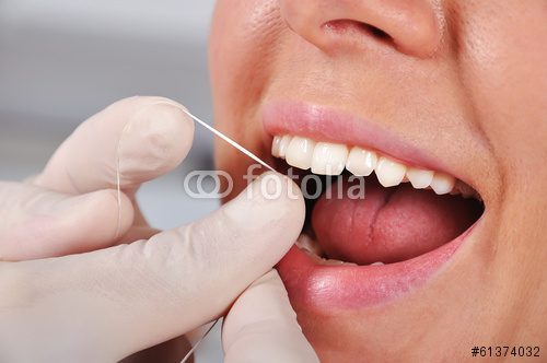 Cosa è lo sbiancamento dentale?