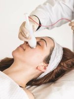 Elettroporazione in Odontoiatria Estetica: La Soluzione Innovativa per Rughe e Ringiovanimento del Sorriso