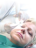 La Radiofrequenza in Medicina Estetica: Un Trattamento Innovativo per il Ringiovanimento del Viso.