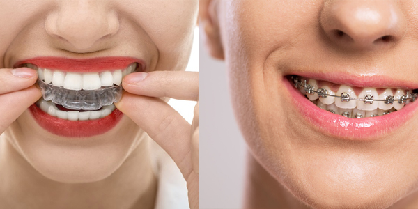 Conservativa ed Endodonzia