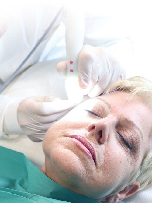 La Radiofrequenza in Medicina Estetica: Un Trattamento Innovativo per il Ringiovanimento del Viso.